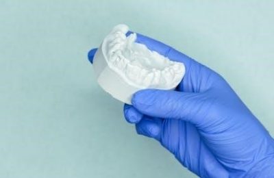 denture teeth mold guide